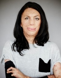 Turia Pitt